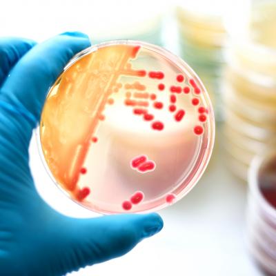 Scientist holding petri dish